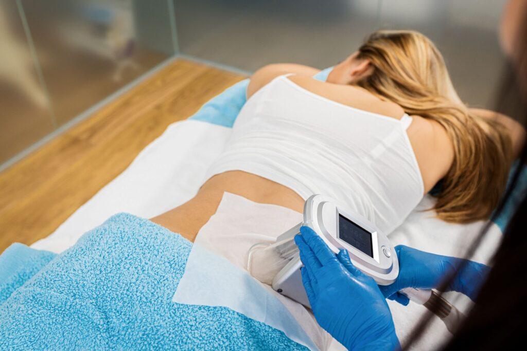kryolipolyse anwendung ruecken coolsculpting behandlung praxis